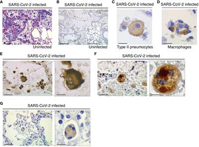 The purinergic receptor P2X7 and the NLRP3 inflammasome are druggable host factors required for SARS-CoV-2 infection